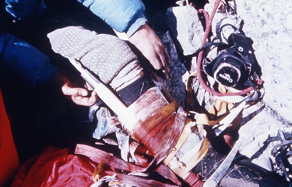 Injury of climber Gaylord Campbell, 1967 rescue Photo credit:  Rick Reese
